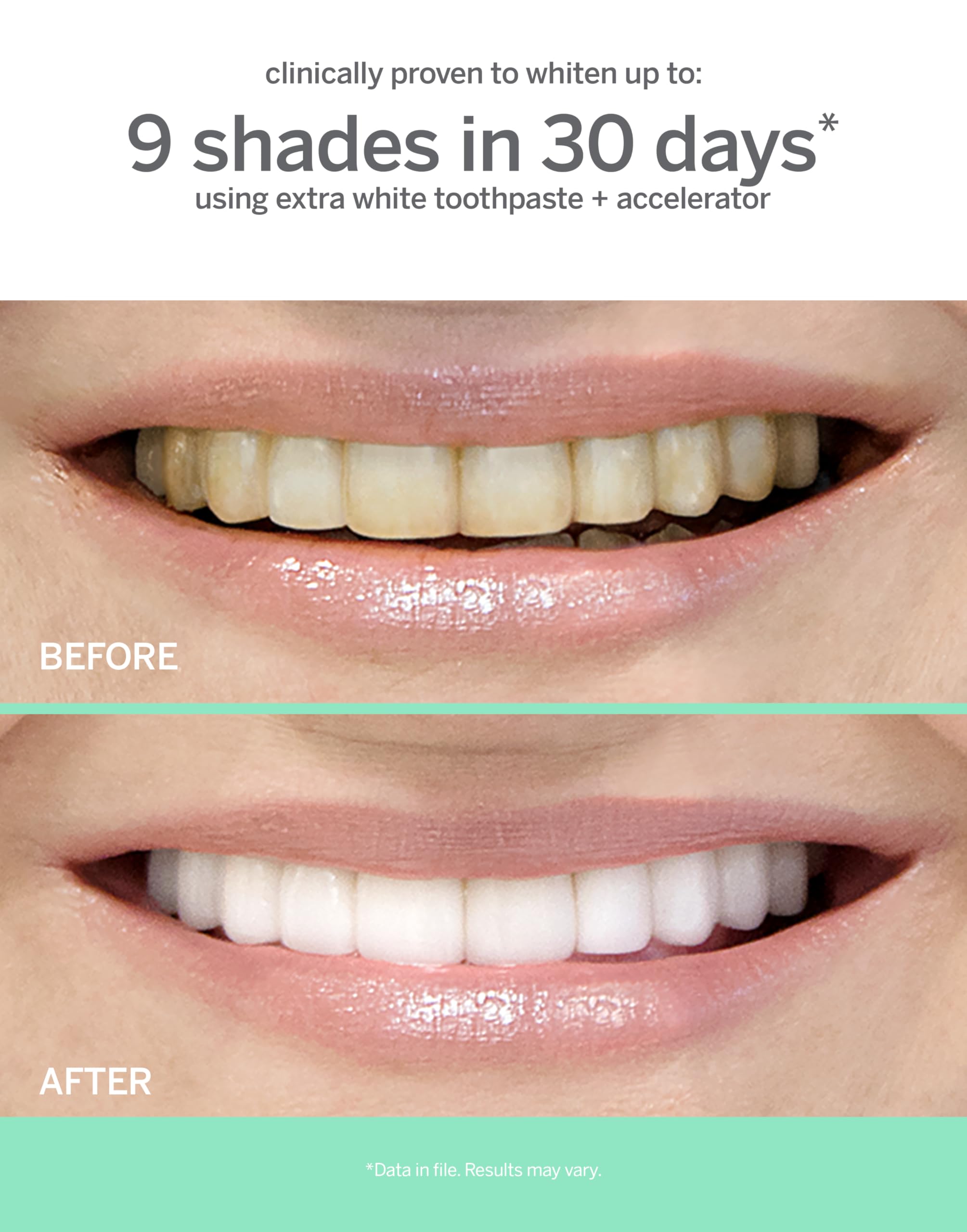 Enamel-safe whitening gel for teeth whitening