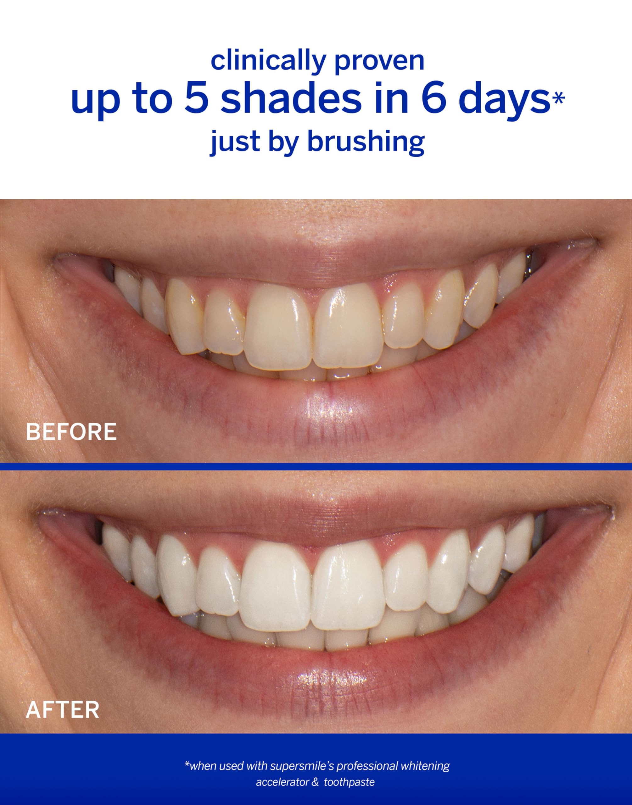 8 oz Supersmile whitening accelerator bottle on white background