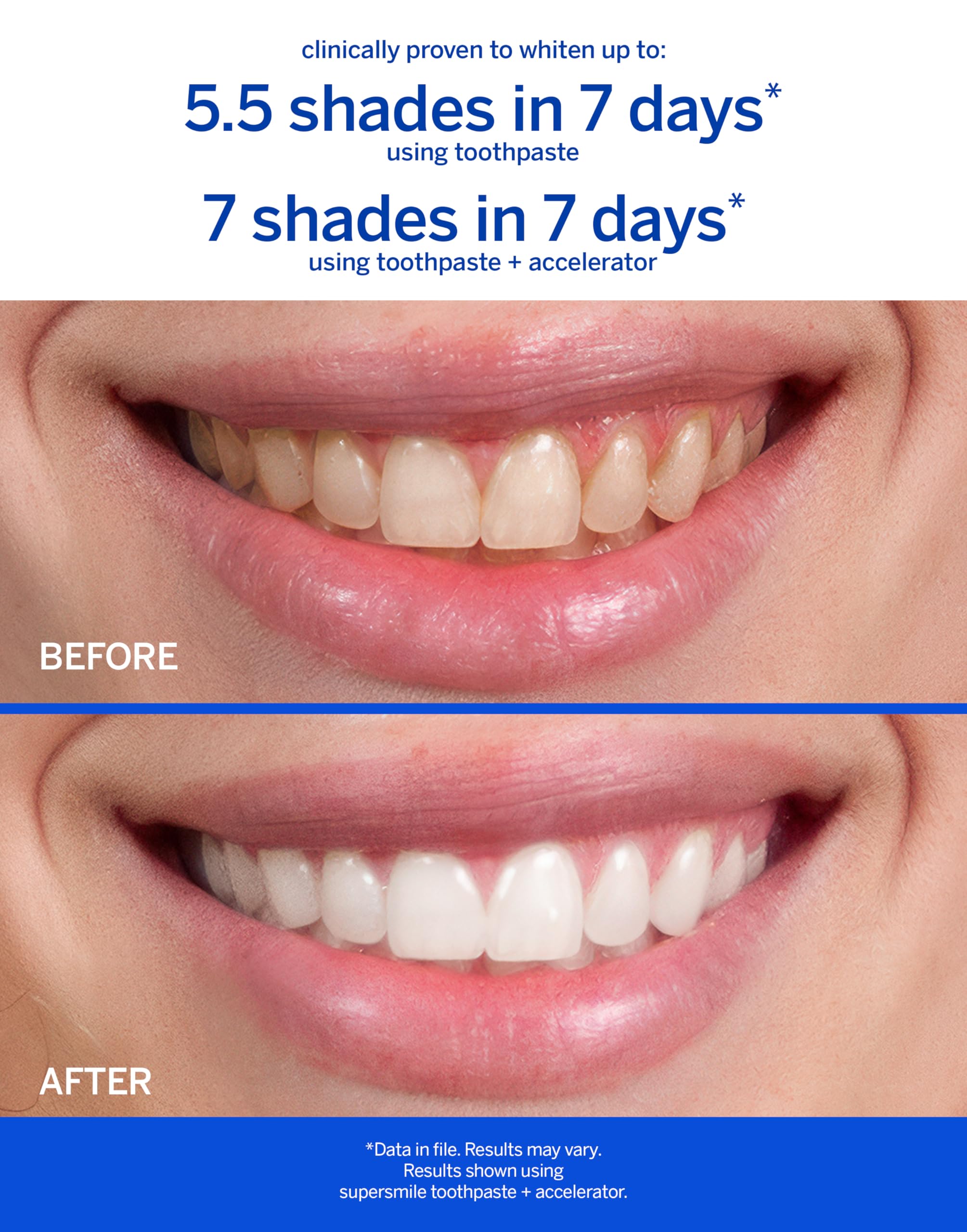 Packaging of Supersmile Rosewater Mint Whitening Toothpaste