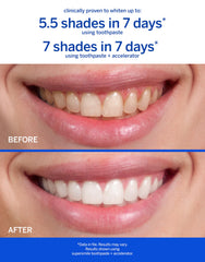 Packaging of Supersmile Rosewater Mint Whitening Toothpaste