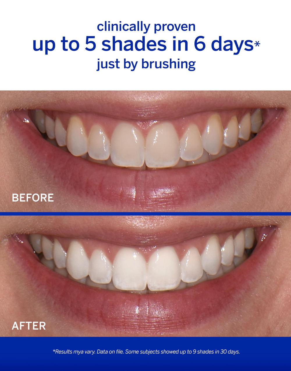 Whitening toothpaste tube and accelerator bottle on dark surface