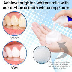 Applying ShinePen to tooth stain