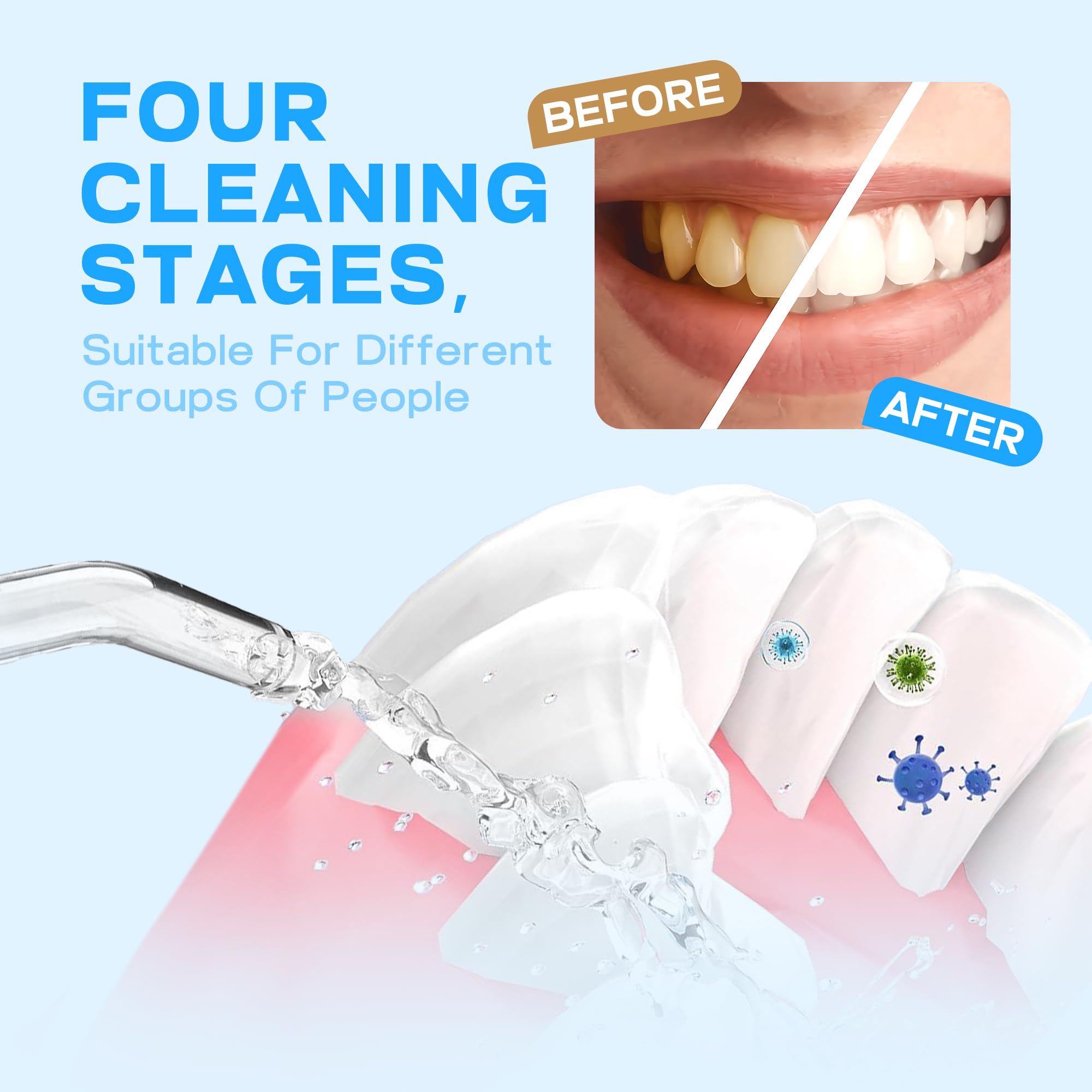 Using TBPO water flosser for braces and gums