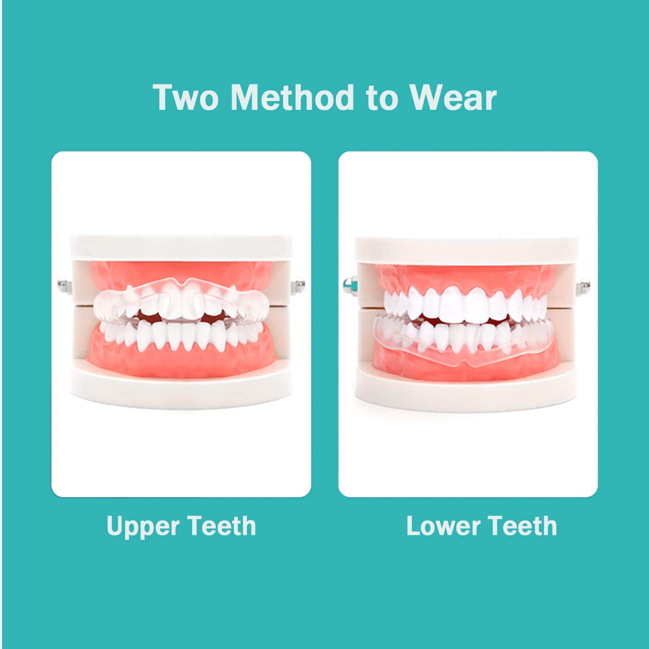 Brace-friendly anti-grinding mouth guard