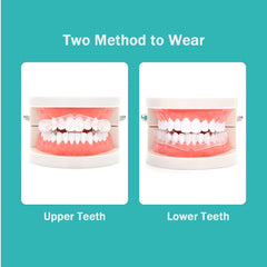 Brace-friendly anti-grinding mouth guard