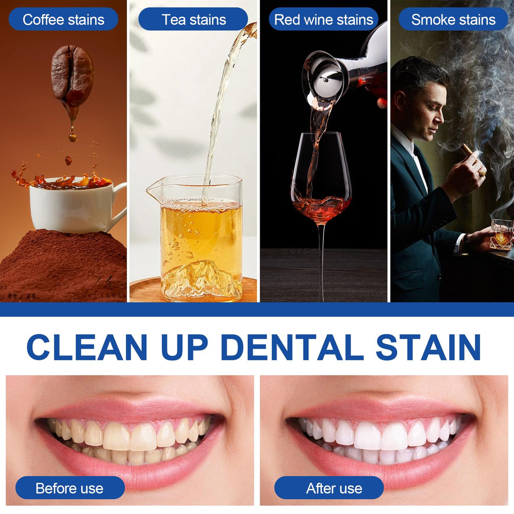 Elegant, compact design of the teeth whitening pen