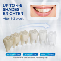 Whitening pen gel being applied to a tooth