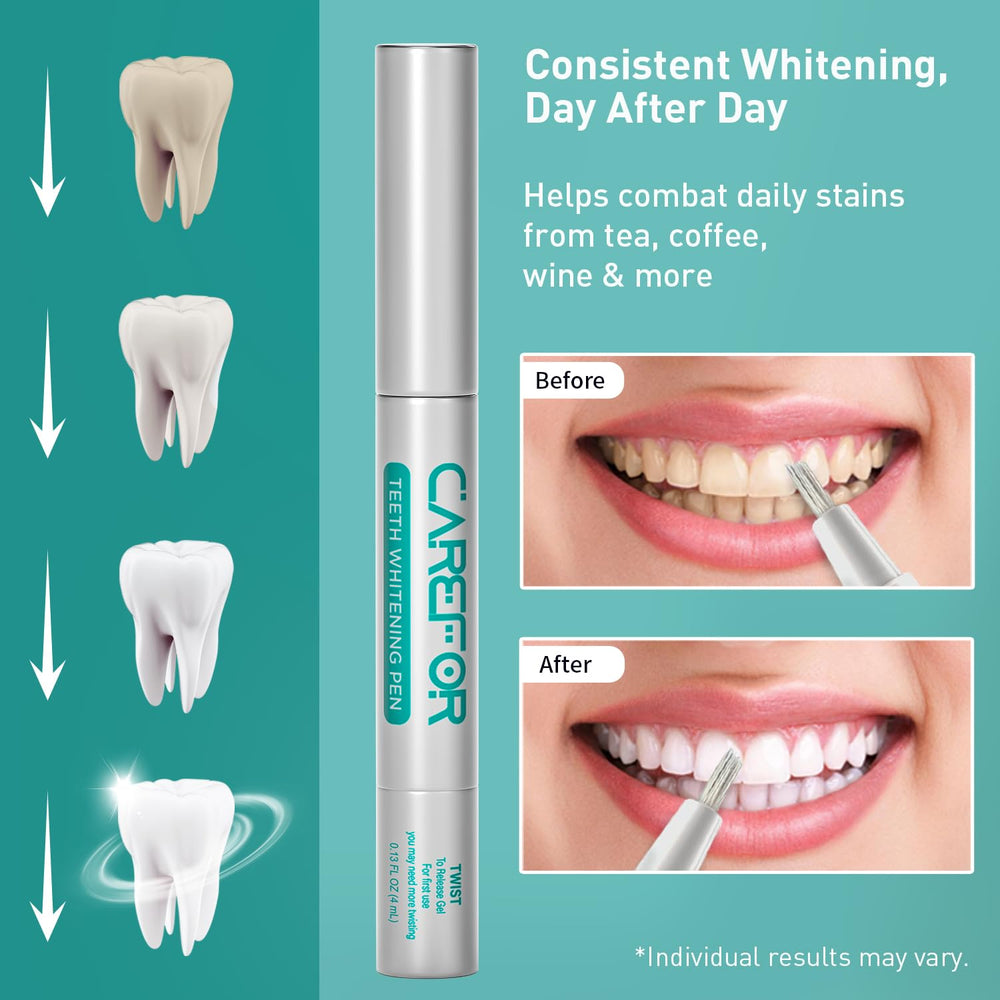 Two 8ml whitening gel pens in travel case