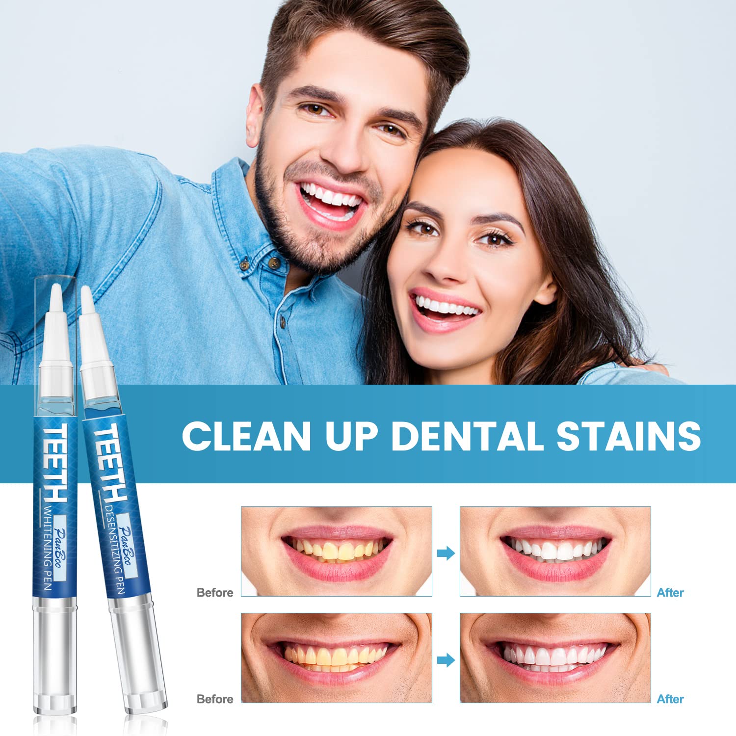 Close-up of whitening pen tip for precise application