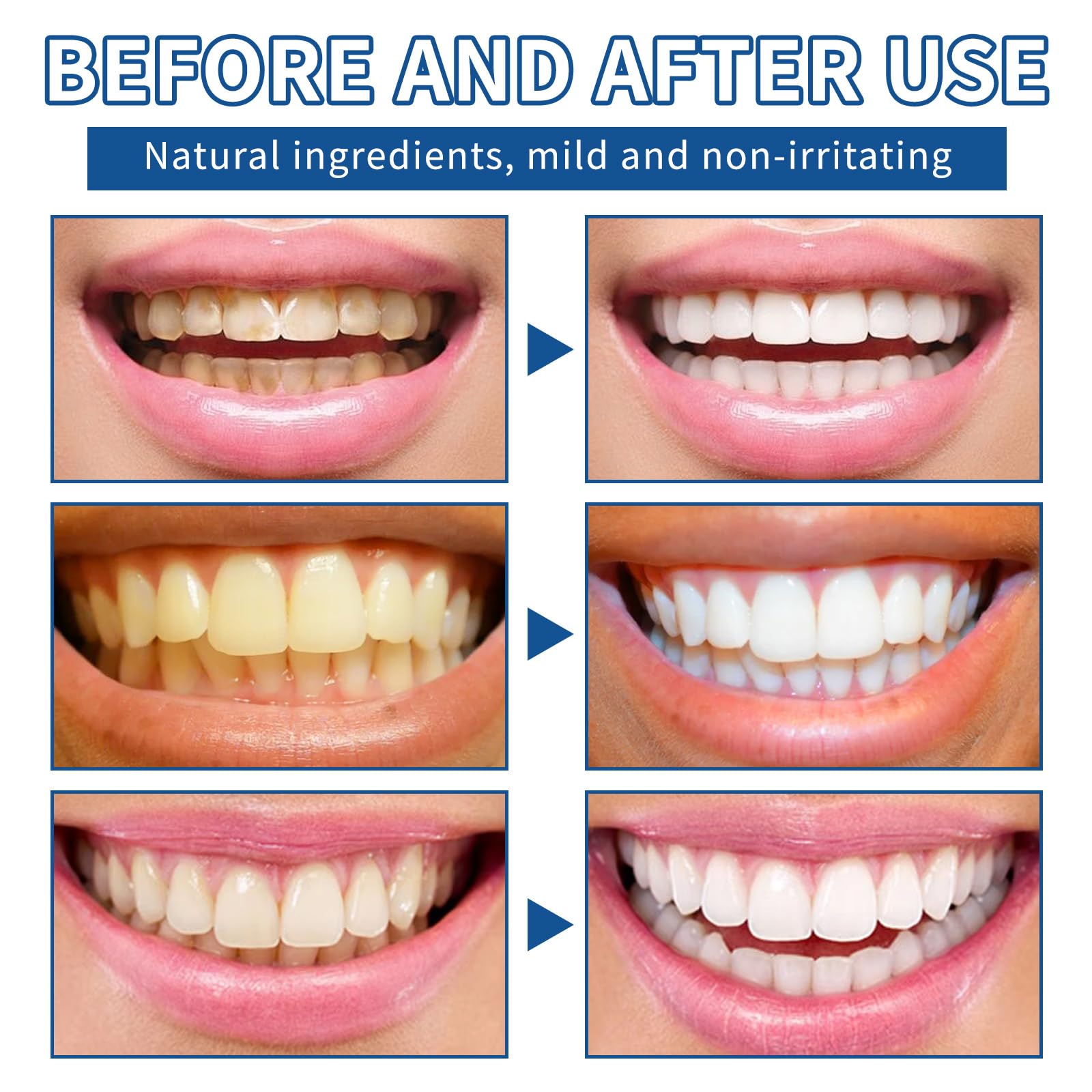 Bright smile after whitening