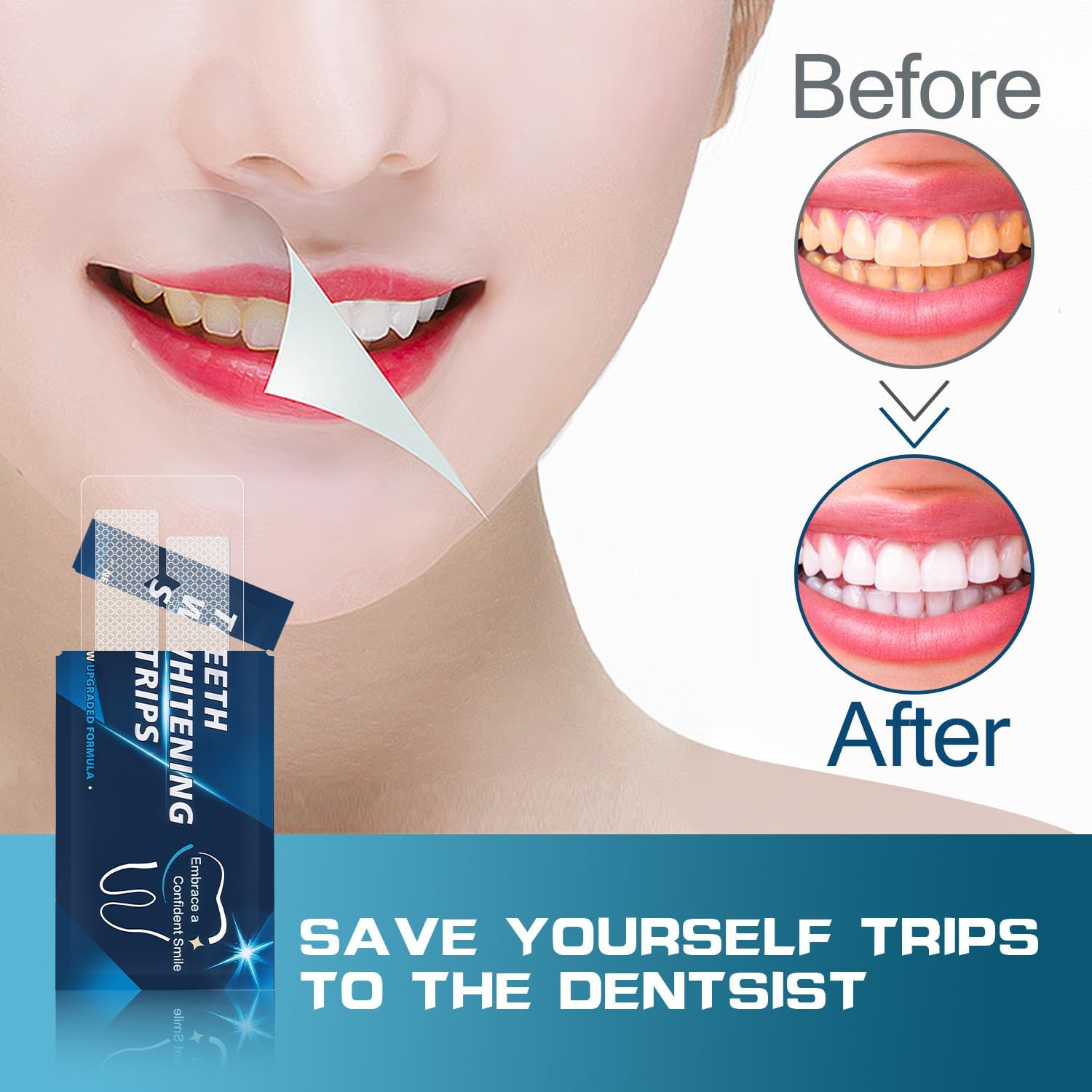 Whitening strips being applied to teeth