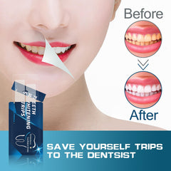 Whitening strips being applied to teeth