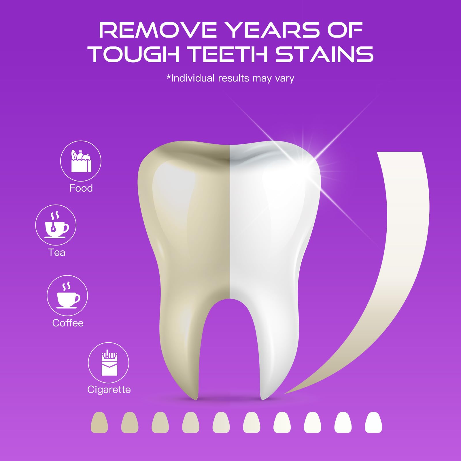 Upper and lower whitening strips applied to teeth for whitening