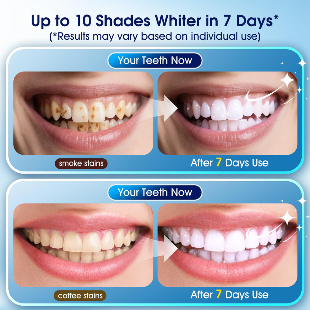 Three whitening pens and two desensitizing pens