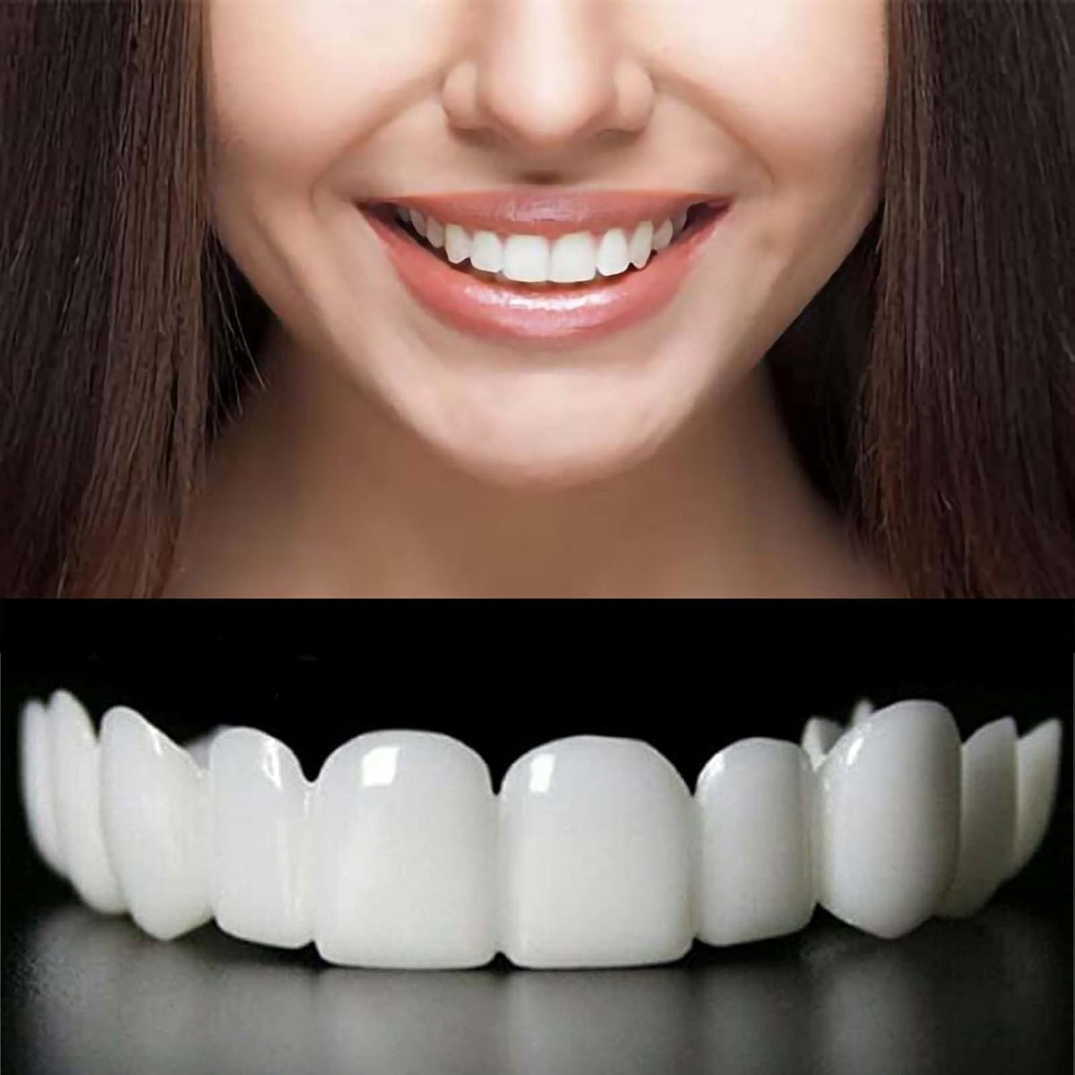 Two-pair set of temporary adjustable smile support with top and bottom pieces