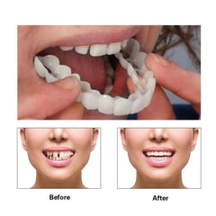 Aligners ready to wear after cleaning