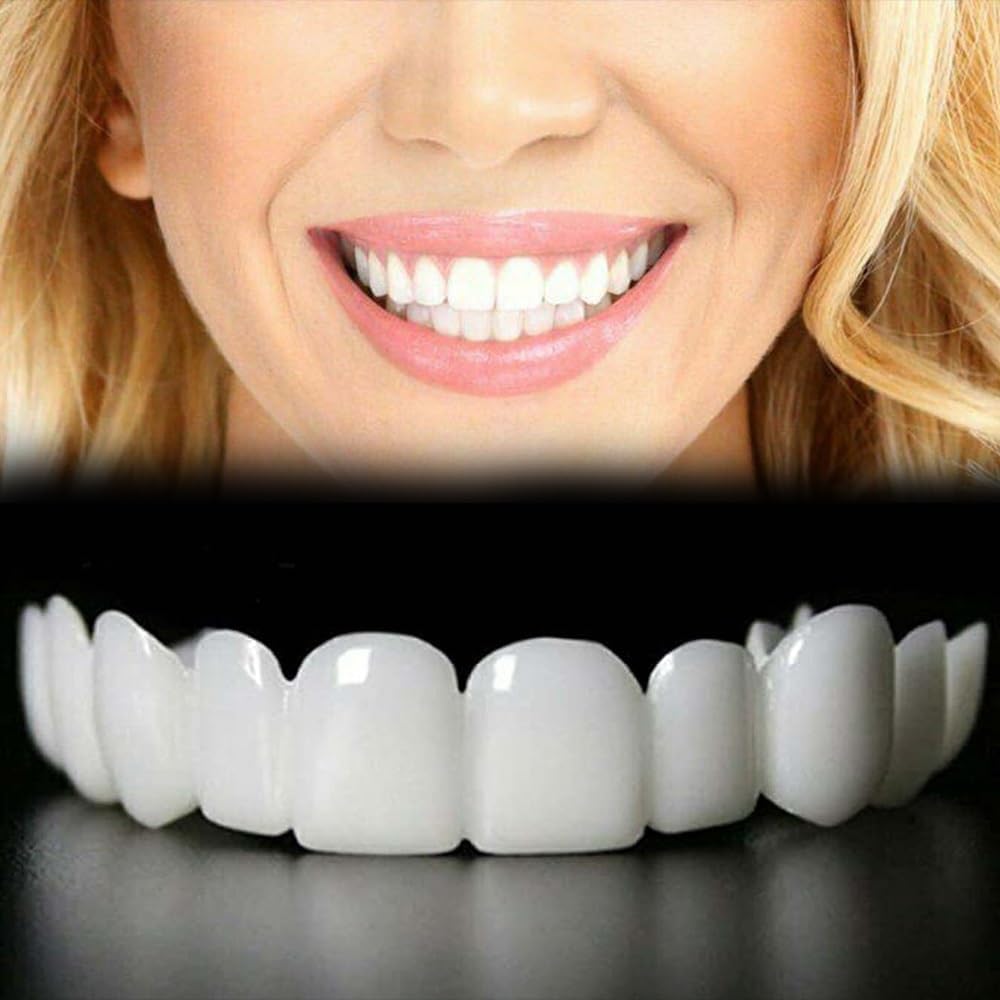 Temporary Adjustable Smile Support – 2 Pairs with top and bottom included, front view