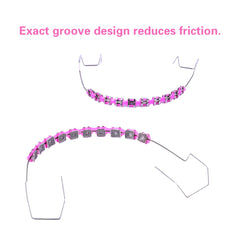 Blue clip-on braces showing metal brackets and ligatures