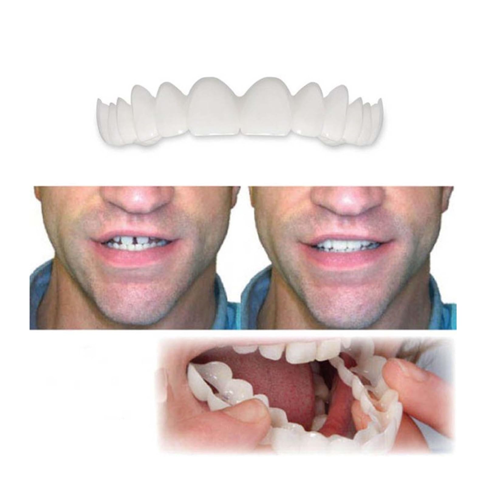 Adjustable size whitening trays for most people