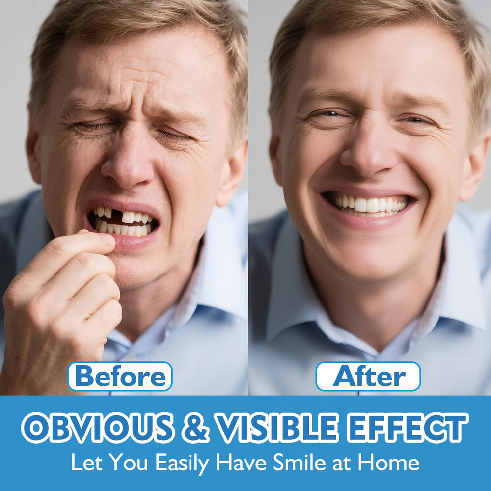 Temporary dentures kit for quick smile restoration
