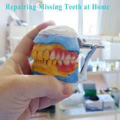 Temporary teeth replacement set for natural-looking smile