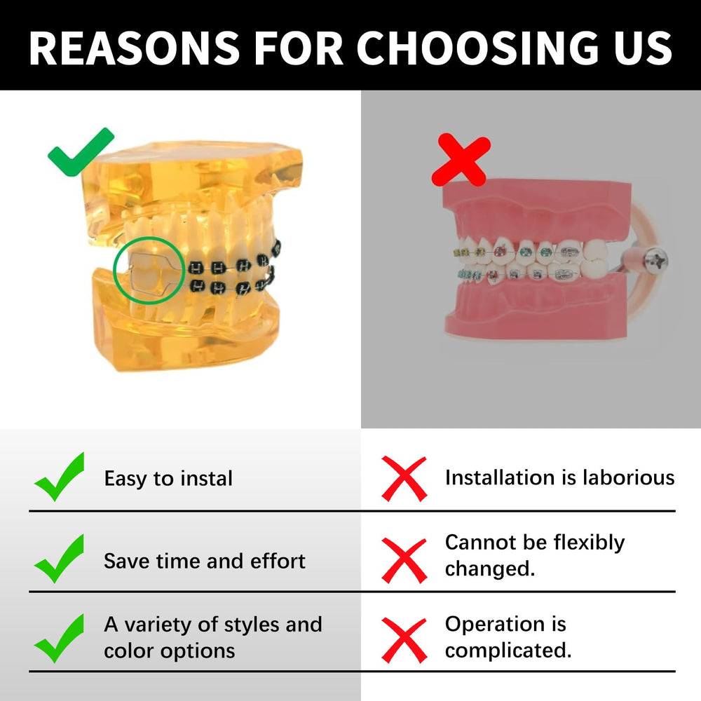 Orthodontic teaching prop displayed on dental model for students