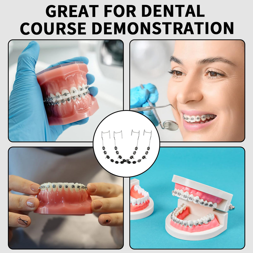 Durable and easy-to-install fake braces materials close-up