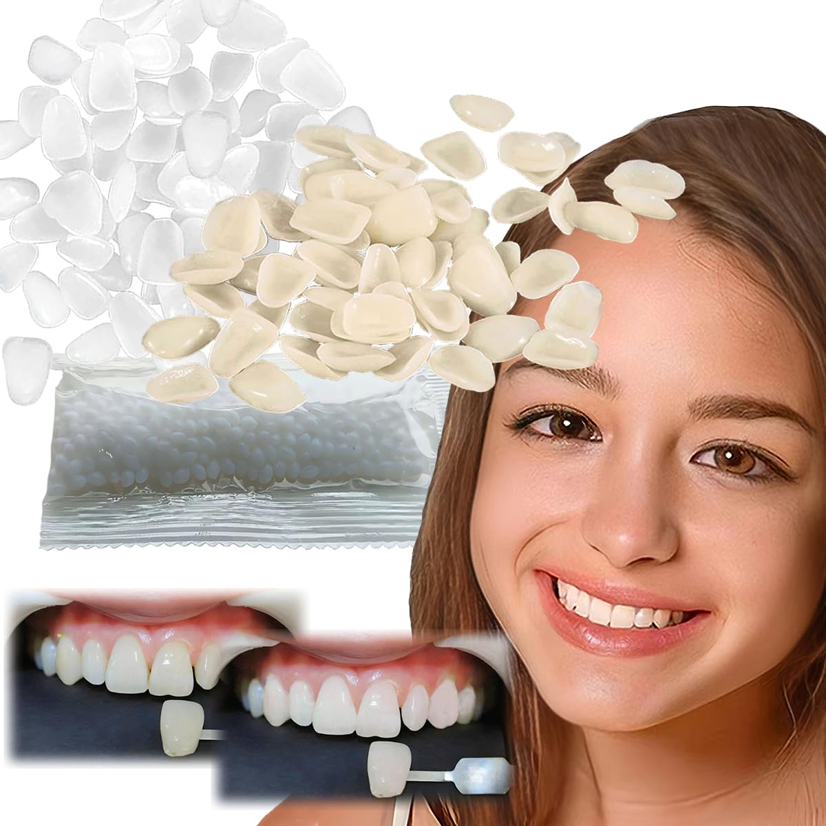 Open box of Temporary Tooth Repair Kit 80 Pcs in yellow and white