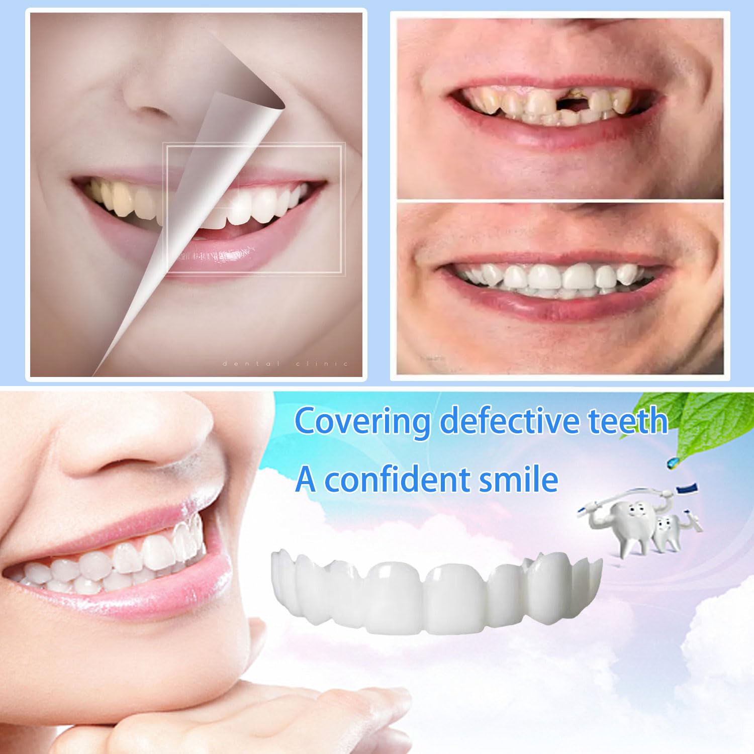 Veneer set after use demonstrating easy cleaning