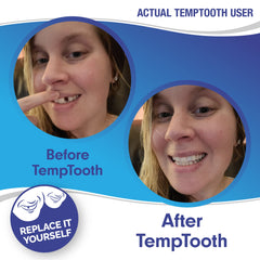 FDA-approved material used in Temptooth kit
