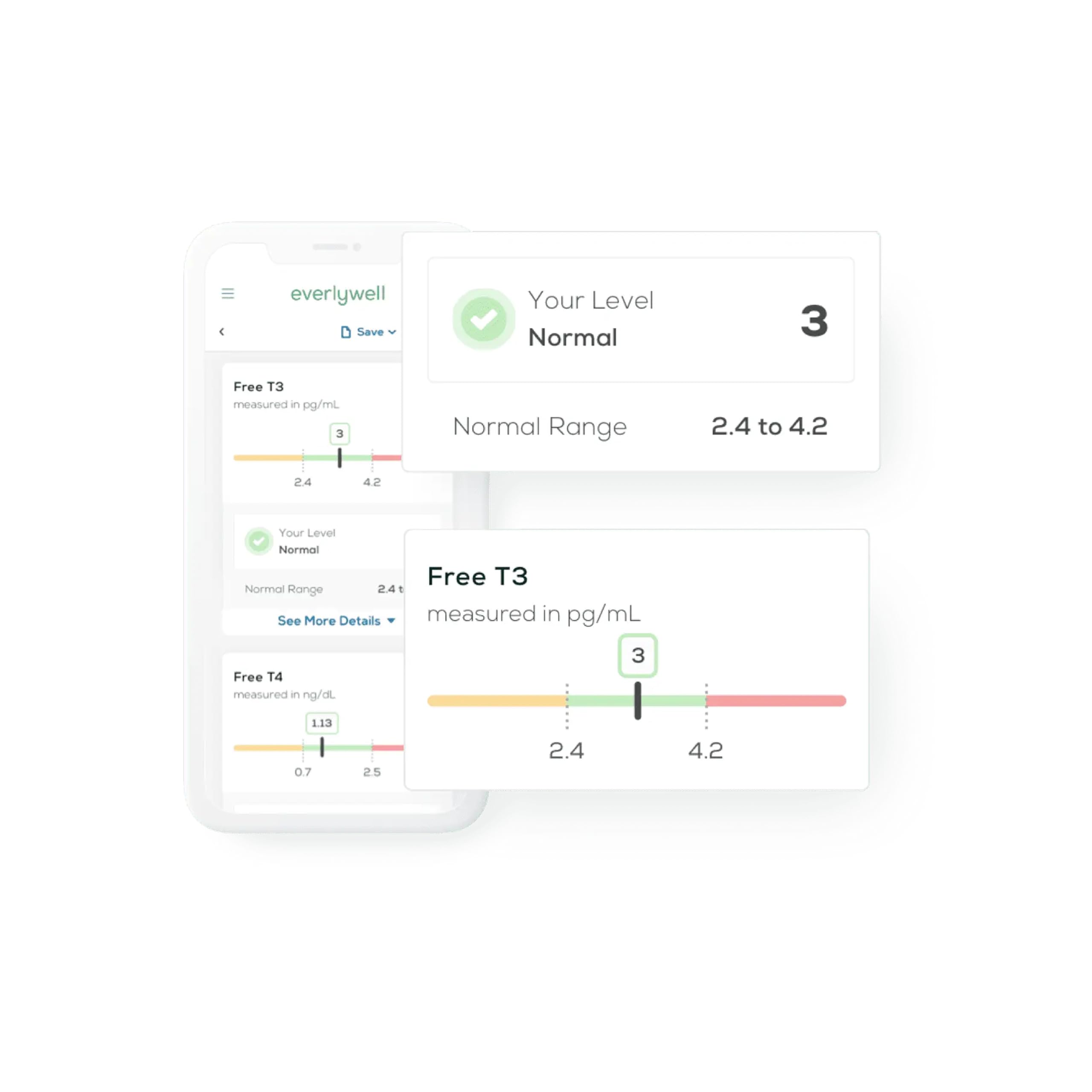 Thyroid antibodies TPO testing image