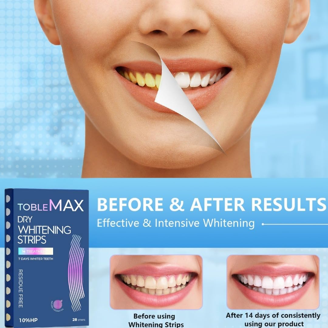 Strips applied to upper and lower teeth during whitening