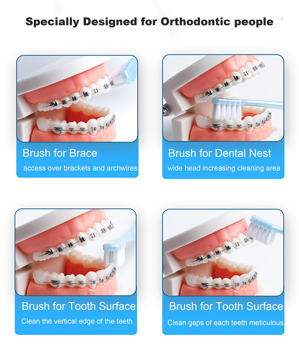 Tongue cleaner feature on braces toothbrush