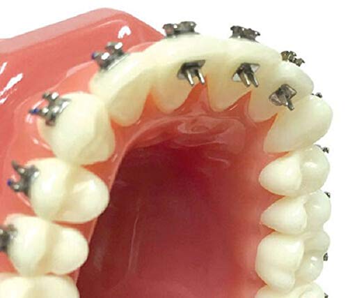 Foil mesh bonding base of Tongue Tamers