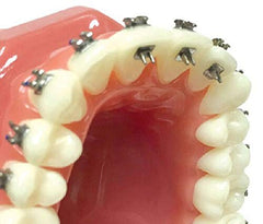 Foil mesh bonding base of Tongue Tamers