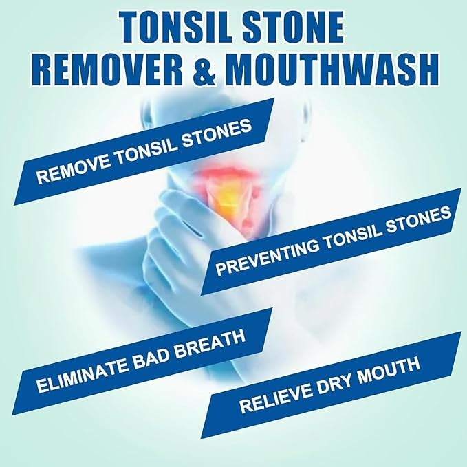 Packaging of Tonsil Stone Mouthwash