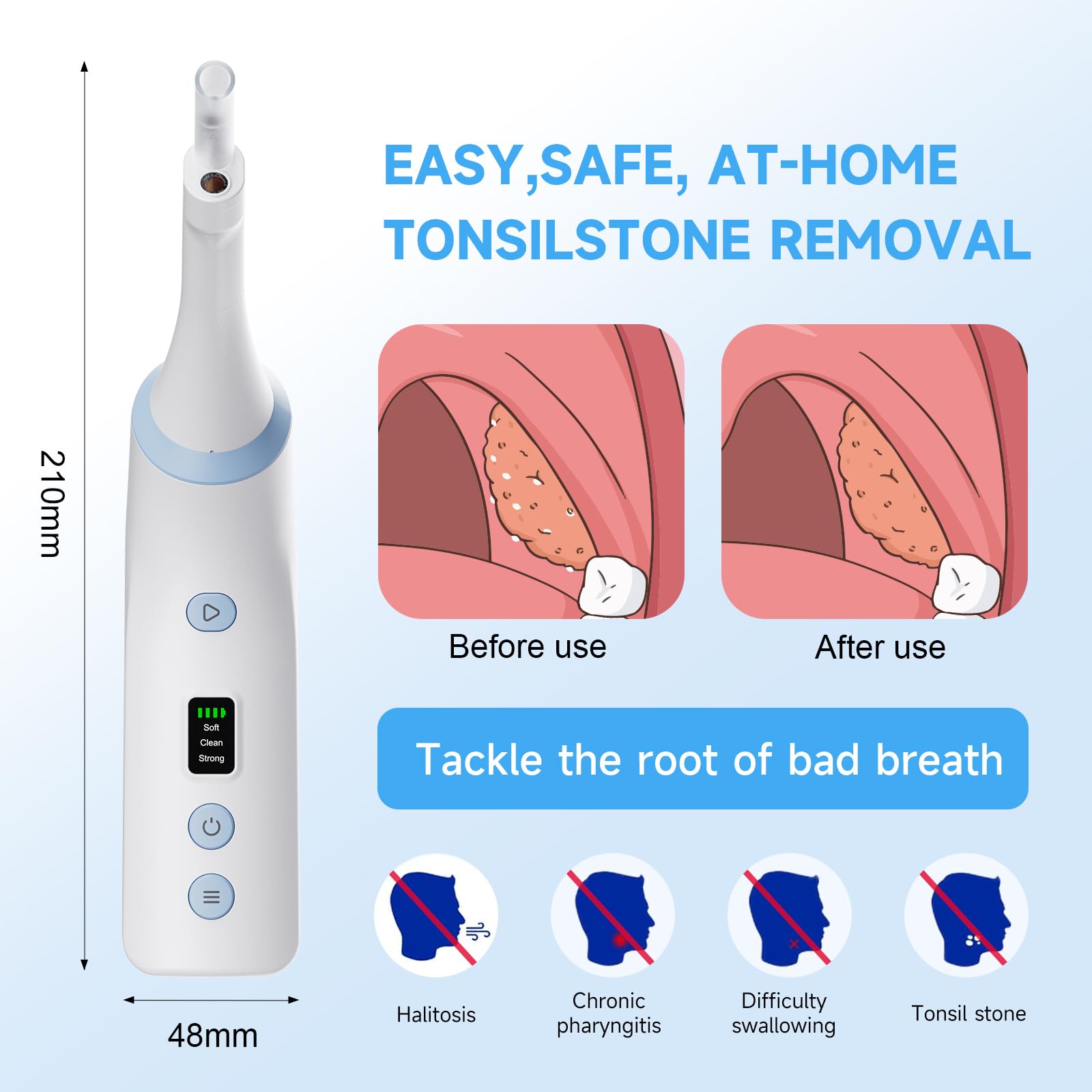 Vacuum tool for tonsil stones