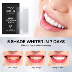 Whitening strip placed on upper teeth for demonstration