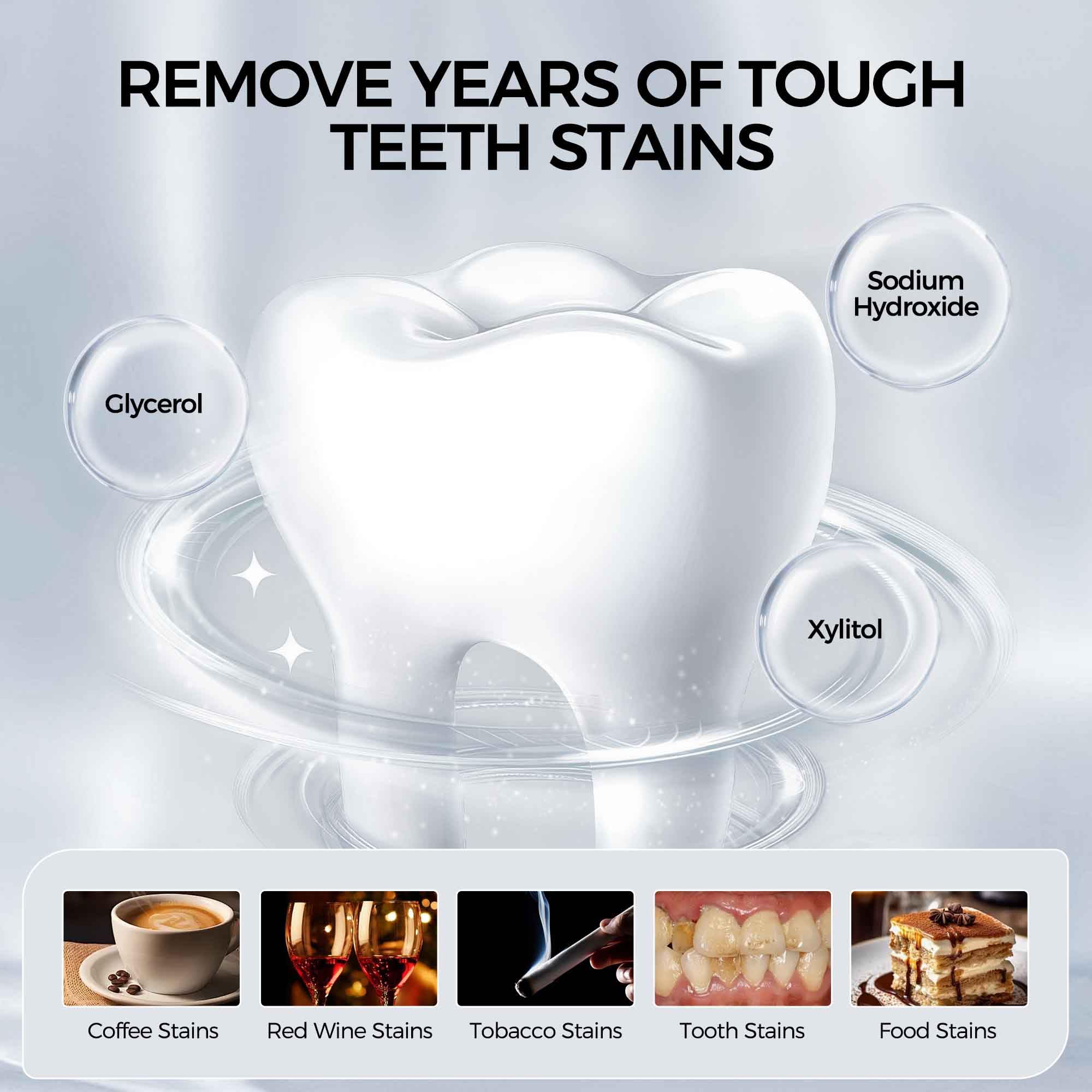 Before and after whitening results on teeth