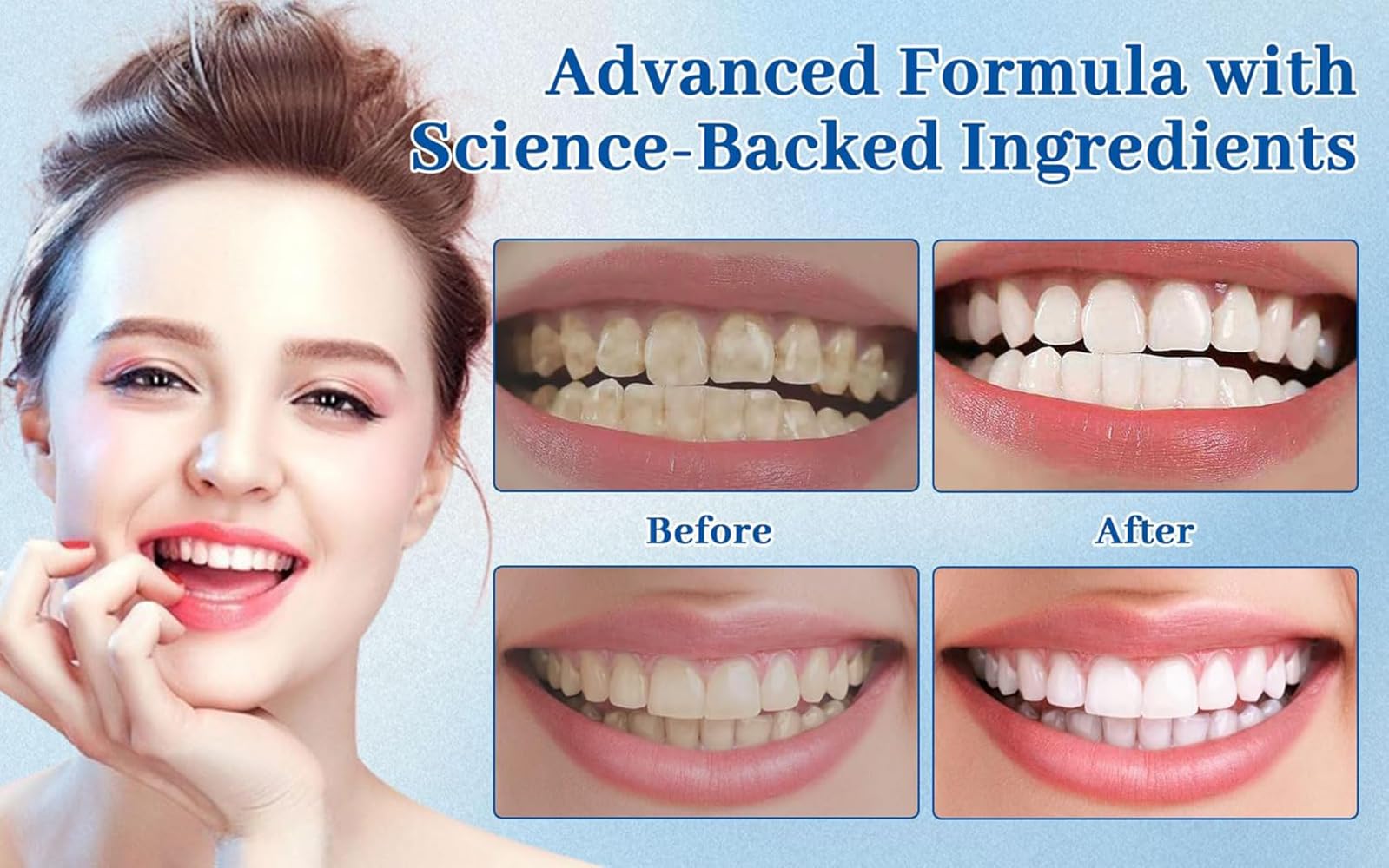 Tooth enamel protection and remineralization concept