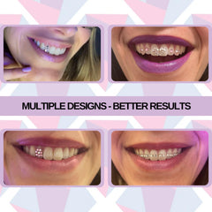 Dental-grade glue and UV curing light for teeth gems