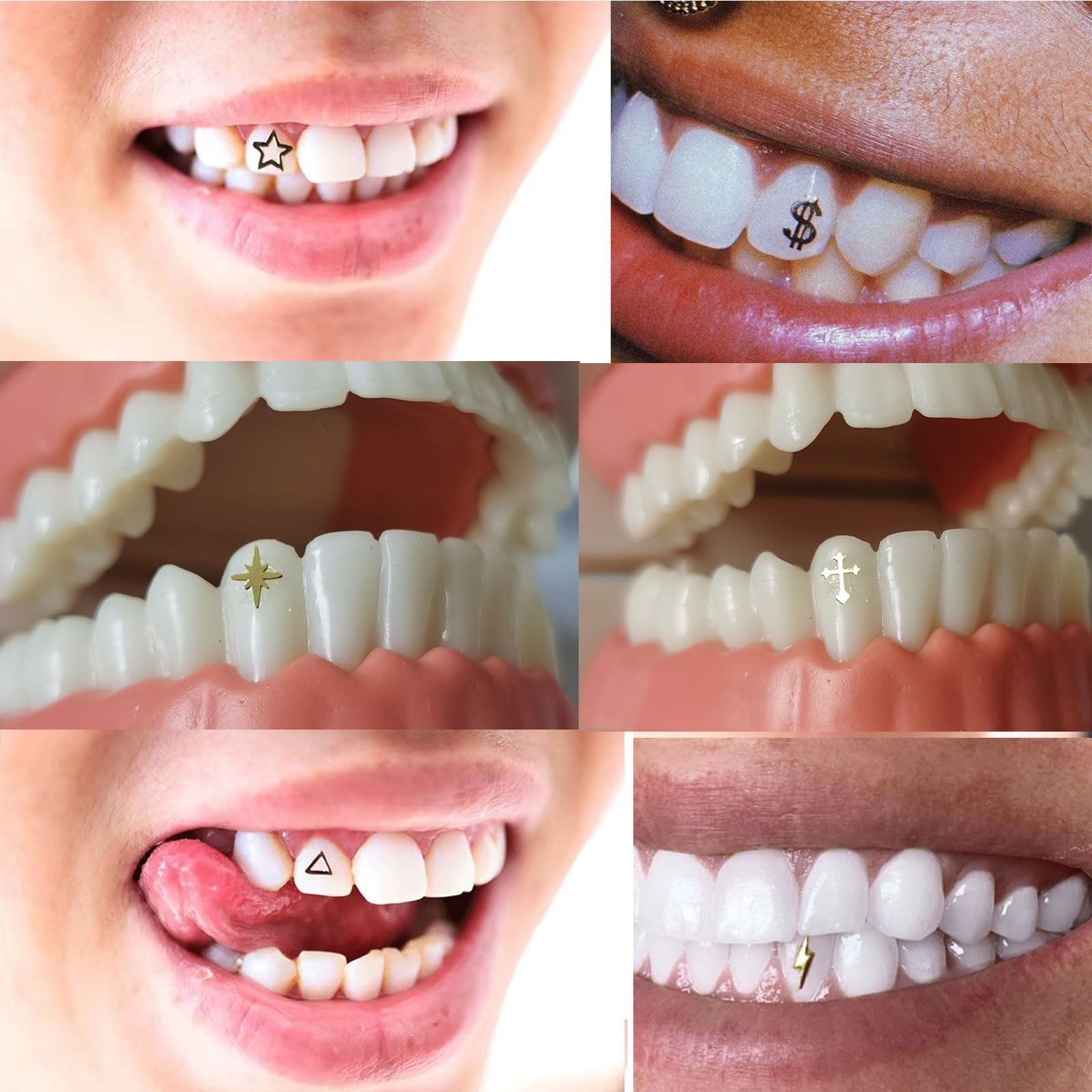 Gold-tone tooth gems shown on teeth (concept)