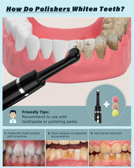 Black tooth polisher kit – side view