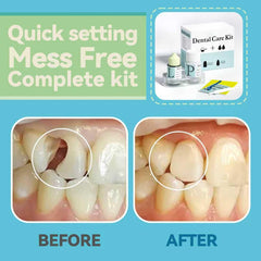Zinc Oxide Eugenol Cement tube for temporary dental restoration