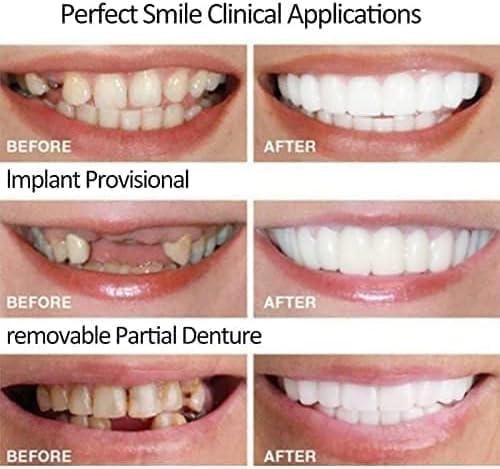 Man applying tooth repair kit at home