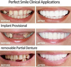 Man applying tooth repair kit at home