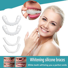 Close-up of natural white smile after using the kit