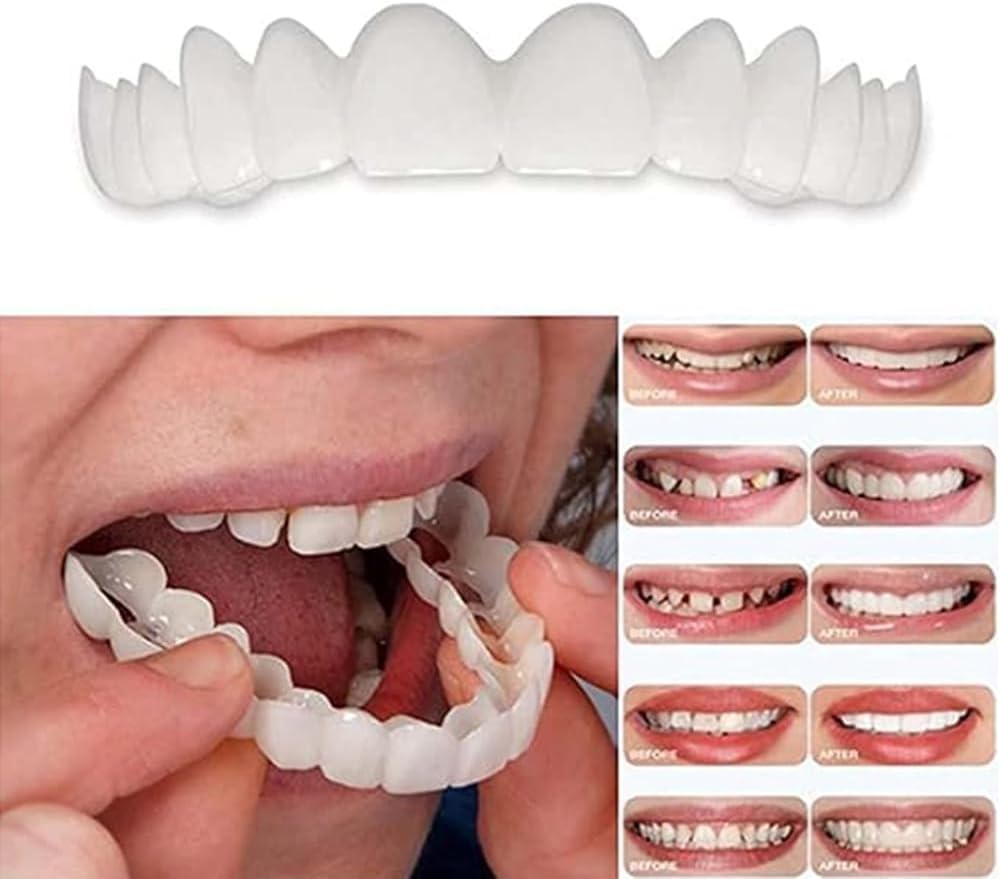 Box and application steps of tooth repair kit