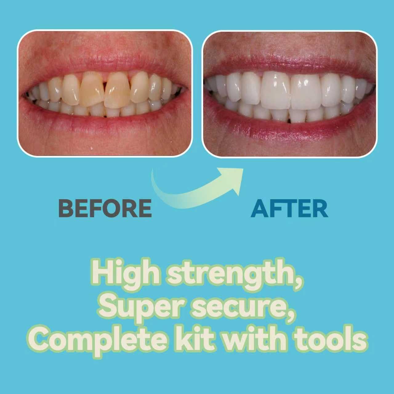 Person smiling after using the temporary tooth repair kit