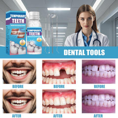 Five tools included in the kit laid out